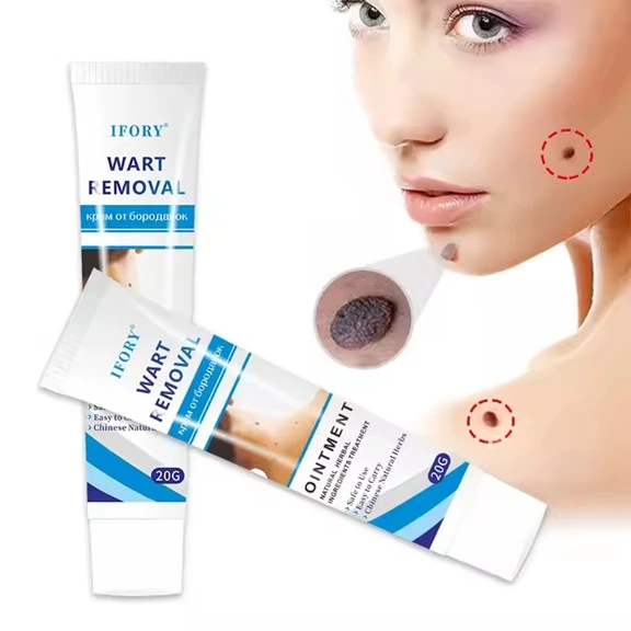 Wart Removal Ointment